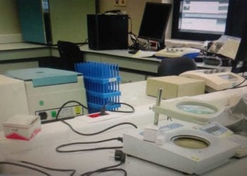 Covid-19: sanidad confirma 16 nuevos casos de coronavirus en las últimas 48 horas en Guinea Ecuatorial