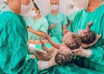 Después de tener un hijo en el primer embarazo y dos en el segundo, una mujer da a luz a trillizos