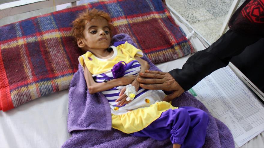 La OCHA presenta al Consejo de Seguridad un plan para impedir una hambruna de proporciones históricas en Yemen